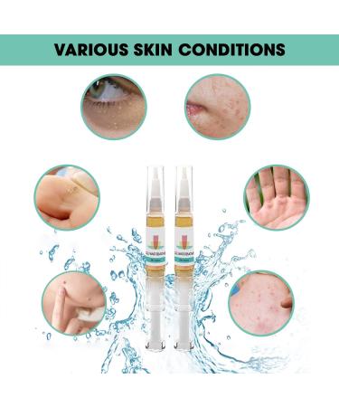 Inadine Wart Remover - Quick & Safe Treatment for All Skin Types - 2-in-1 Wart & Verruca Remover - Natural & Safe - 2 Pens per Box - Buy Online on GoSupps.com