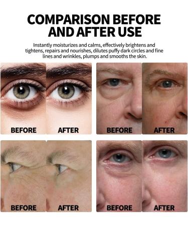 Mens Expert Hydra Energetic Eye Roller Men Plus Expert Hydra Energetic Eye Roller Men's Eye Roller for Puffy Eyes and Dark Circles. (1pcs) - Buy Online on GoSupps.com