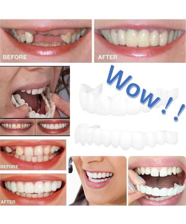 Upper and Lower Veneer Dentures for Women and Men - Natural Shade Fake Teeth - Instantly Fix Your Smile at Home! - Buy Online on GoSupps.com