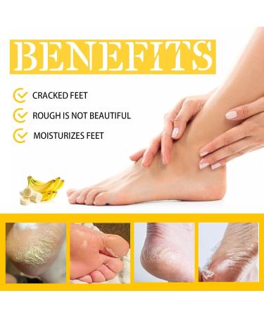 2pcs Cracked Heel Banana Cream - Softens, Moisturizes & Removes Dead Skin for Dry Heels - Buy Online on GoSupps.com