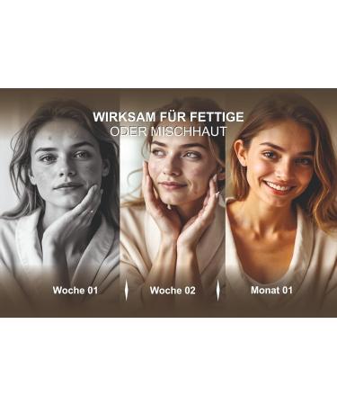  BIO JALAL Set of 2 Aleppo Soap 5% Laurel Oil 95% Olive Oil Hand Soap Face Body and Hair 400 g Handmade in Turkey - Buy Online on GoSupps.com