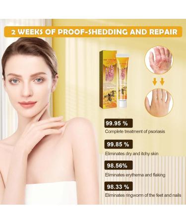 Premium Bee Venom Cream for Psoriasis Treatment & Wart Relief | Natural Soothing Repair Cream - Buy Online on GoSupps.com