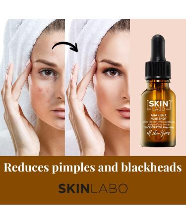 SKIN LABO SkinLabo Active Serum Aha + Bha Eliminates Surface Dead Cells Skin Perfecter with Exfoliating and Purifying Action 15 ml (Old Version) - Buy Online on GoSupps.com
