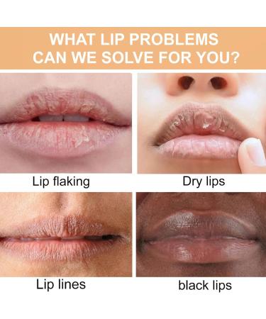 Turmeric Lip Balm Stick Turmeric Hydrating Lip Balm Lip Lightening For Dark Lips Lip Pigmentation Treatment Lip Repair Balm Long Lasting Moisturizing Lip Care Cream for Dry Lips & Cracked Lips - Buy Online on GoSupps.com