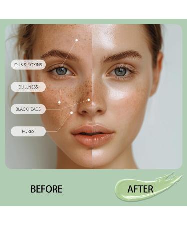 Green Tea Clay Mask for Oily Skin - Deep Cleansing Dark Spot & Acne Treatment - 3.52 Oz - Buy Online on GoSupps.com