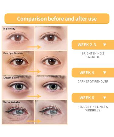 BREYLEE Vitamin C Serum for Face & Eye - Brightening Dark Spot Remover Anti-Aging Moisturizer with Hyaluronic Acid & Vitamin E - 0.6 oz - Buy Online on GoSupps.com