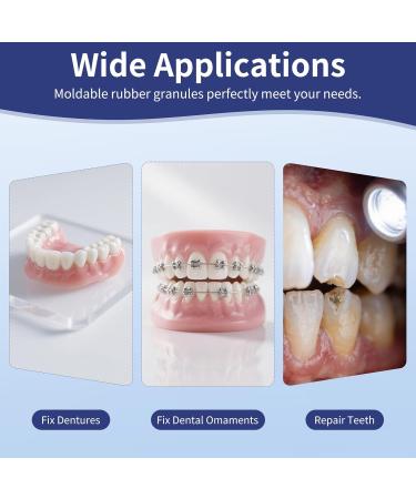 DIY Temporary Tooth Repair Kit - Heat Fit Beads for Missing & Broken Teeth 4 Tools Included Natural Comfortable Men & Women - Regain Confident Smile - Buy Online on GoSupps.com