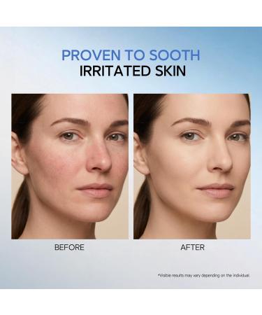 HKH Copper Peptides Serum for Face: 38 Capsules Anti-aging Facial Serum with GHK-Cu Peptide & Hyaluronic Acid for Fine Lines Wrinkles & Dryness - Daily Use for 30+ Women - Travel-Friendly - Buy Online on GoSupps.com