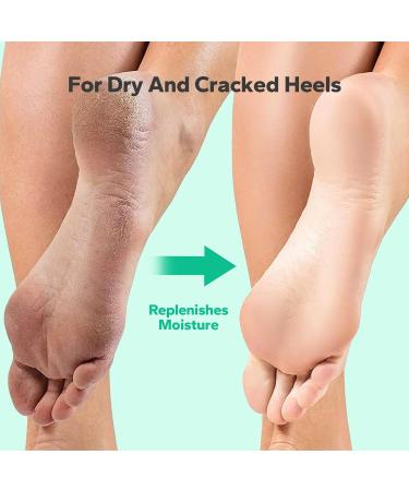 Extra Strength Callus Remover Gel for Feet - 8.45 fl.oz Powerful Foot Care Solution Home Use Calloused Feet Remover - Buy Online on GoSupps.com