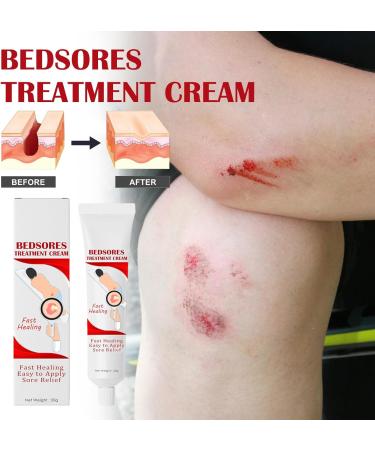  JPSDOWS Anti-Decubitus Cream | Anti-Decubitus Care 20g Healing Cream for Raping Pain Relief for Irritated Skin Difficult to Heal Skin - Relief Jpsdows - Buy Online on GoSupps.com