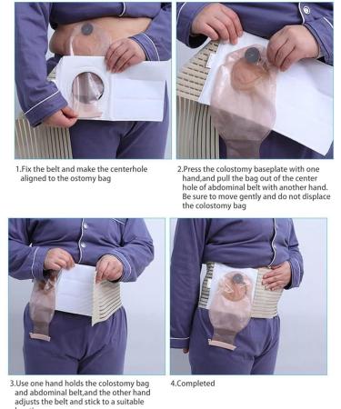 Shanrrow Stoma Belt & Hernia Support Bandage - 3.14 Opening for Colostomy Bags | Prevent Parastomal Hernia | International Shipping - Buy Online on GoSupps.com