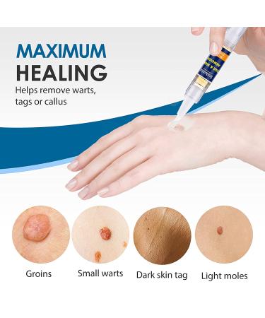 Extra Strength Skin Tag Remover | Wart Removal | Tag Dries and Falls Away | Natural Ingredients | All Skin Types - Buy Online on GoSupps.com