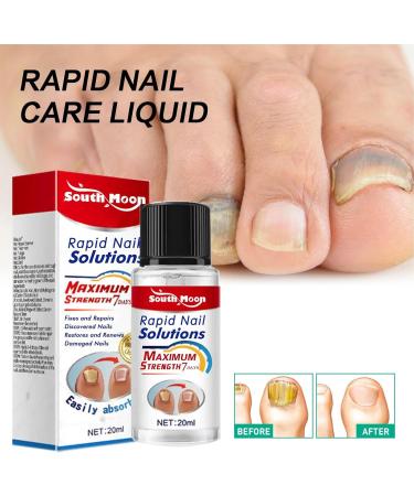 Cuticle and Nail Oil Nail Repair for Growth - Gentle Nail Cuticle Oil Nail Hardener Nail Growth Polish for Adults Teksome - Buy Online on GoSupps.com