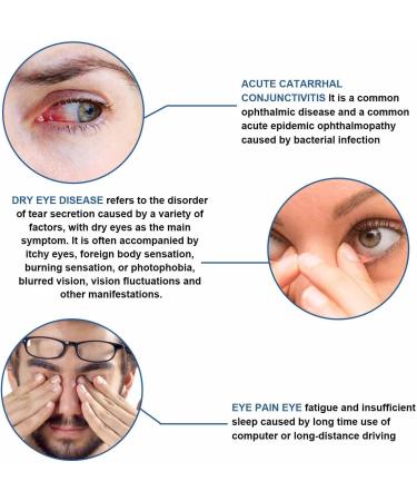 EXQST Soothing Eye Ointment 20g Rehydrates and Rejuvenates Dry Eyes Night Ointment for Dry Eyes Soothes Eyes Reduces Redness and Eye Pain - Buy Online on GoSupps.com