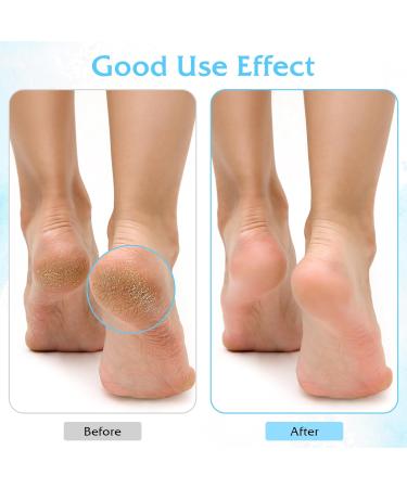 Aloe Socks - 3 Pairs Moisturizing Spa Socks for Dry Cracked Feet | Infused Gel Sleeping & Fuzzy Lotion Socks | Perfect Gift for Women - Buy Online on GoSupps.com