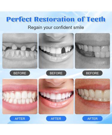 PGonline Temporary Tooth 30g Tooth Repair Kit Dental Plasters Fixed Dental Beads Temporary Teeth False Tooth for Missing Broken Teeth Dental Filling Material - Buy Online on GoSupps.com