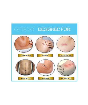 Scar Removal Silicone Tape for Surgical Scars, Keloids & C-section - 60in Roll, Medical Grade, Latex-Free - Buy Online on GoSupps.com