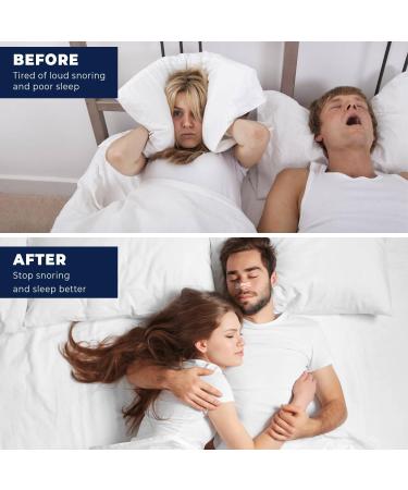 50 Piece Nose Paving Snoring Solution | Better Breathing Snor Popper | Anti-Snoring Nasal Spreaders for Sleep & Sports - Buy Online on GoSupps.com