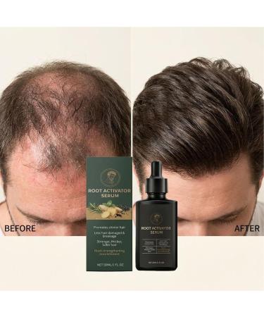 Solution paississante pour cheveux soin du cuir chevelu non gras flacon de 30 ml solution capillaire effil e liquide volumineuse formule nourrissante du cuir chevelu usage quotidien - Buy Online on GoSupps.com