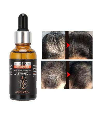 30ML Hair Growth Oil - Prevent Hair Loss Nourish Deeply Repair Follicles & Combat Frizz - Buy Online on GoSupps.com