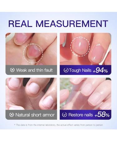 Lot de 2 s rums de soin des ongles - S rum de construction intensif - Pour hommes et femmes - Hydrate les cuticules s ches - S rum nourrissant pour ongles cass s et d color s - Buy Online on GoSupps.com