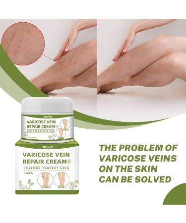 Best Varicose Veins Cream | Spider Vein Treatment | Repair Cream for Legs | 50g International Shipping - Buy Online on GoSupps.com