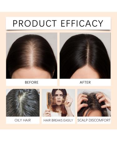 Rubu22a Onion Biotin Shampoo Bar solid shampoo for men and women 3in1 shower soap for hair scalp and beard moisture shampoo vegan handmade 2 pieces 02 g 300er Pack - Buy Online on GoSupps.com