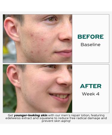 Buy Anti-Aging & Repairing Lotion | Hydrating Face Moisturizer for Men & Women | Ewen Skin Tone | Anti-Oxidant Formula - Shop Internationally - Buy Online on GoSupps.com