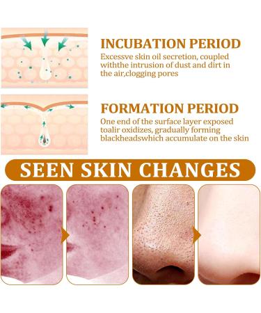 Gold Foil Peel Off Mask Golden Mask Golden Peel Off Face Mask Exfoliating Clean Blackhead Cutin Gold Anti-Aging Face Mask for Deeply Cleans Moisturizing (1 Bottle) - Buy Online on GoSupps.com