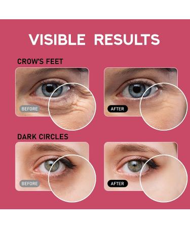 Beaueli Caffeine Eye Cream for Dark Circles, Puffiness & Wrinkles - Korean Anti-Aging Treatment with Hyaluronic Acid & Niacinamide 20ml - Buy Online on GoSupps.com