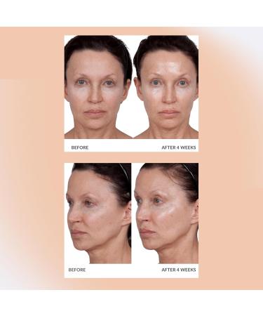 Consult Beaute Volumagen - Collagen Anti-Aging Serum for the Face - Hyaluronic Acid - Skin Nourishing & Plumping - Hydrates and Temporarily Fills for Smoother Bouncy Skin - 2 Oz. Duo (2 Piece Set) - Buy Online on GoSupps.com