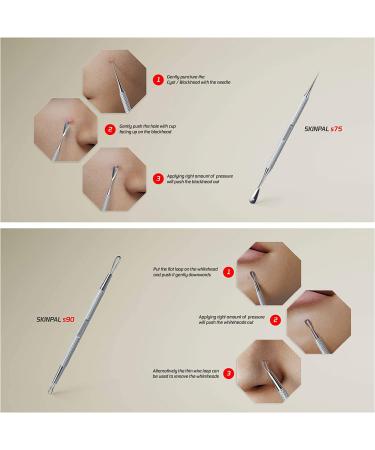 Suvorna Skinpal S100 Pimple Popper Tool Kit - Milia, Whitehead, Blackhead, and Acne Extractor Set - Buy Online on GoSupps.com