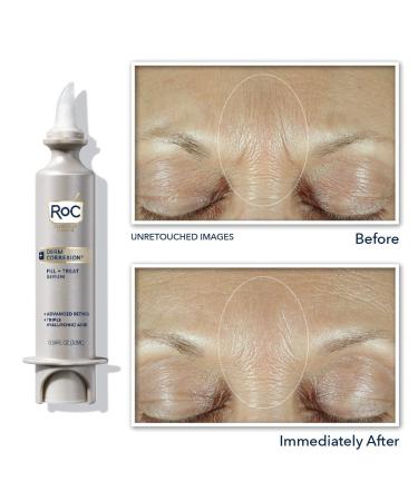 RoC Derm Correxion Fill + Treat Advanced Retinol Serum with Hyaluronic Acid - 15ml + Sample - Buy Online on GoSupps.com
