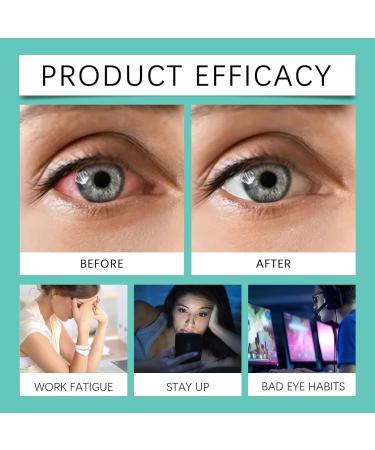 Rouleau am liorant la vision s rum pour les yeux rouleaux de massage des yeux soulage la fatigue oculaire am liore la clart visuelle nourrit les yeux soulage la s cheresse oculaire (1 Pcs) - Buy Online on GoSupps.com