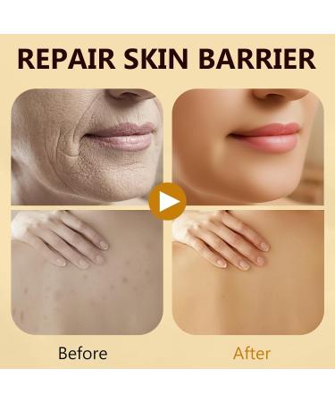 NOBA Bee Venom Cream Bee Venom Skin Trea-tment Cream - Firms & Rejuvenates Skin Reducing Blemishes Gentle & Non-irritation Suitable for All Skin Types - Buy Online on GoSupps.com