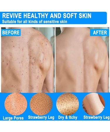 Deep Exfoliating Mitts 2 Pack Microdermabrasion Exfoliating Gloves - Black - Buy Online on GoSupps.com