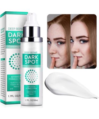 Dark Spot Correcting Glow Serum Korean Dark Spot Correction Serum Skincare Glow Intense Eclaircissant Anti-Stain Cream With Retinol And Hyaluronic Acid Lightening Cream (1) - Buy Online on GoSupps.com
