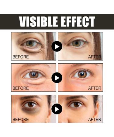 Caffeine & Hyaluronic Acid Under Eye Cream Eye Cream for Dark Circles and Puffy Eyes Caffeine Eye Cream Lifting& Anti Wrinkle Lightweight Eye Cream Anti Aging Caffeine Eye Bag Cream Overnight & Repair - Buy Online on GoSupps.com