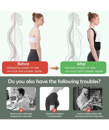 Adjustable Back Support Brace Posture Corrector for Men and Women - Upper Back Straightener for Neck, Shoulders, and Lumbar - Size M - Buy Online on GoSupps.com
