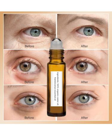 Time Eraser Rollerball with 100% Organic Castor Oil & Frankincense - Anti-Wrinkle Serum for Eyes Reduces Fine Lines (2 PCS) - International Shipping - Buy Online on GoSupps.com