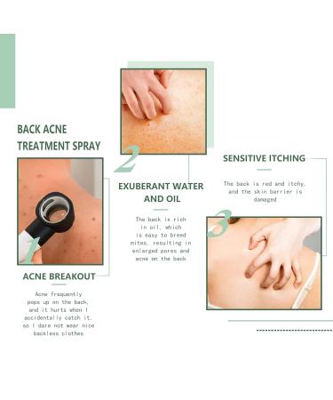 Back Acne Treatment Spray - 2% Salicylic Acid & Herbal Formula - Tea Tree Oil Body Acne Solution - 120ml 2pc - Buy Online on GoSupps.com