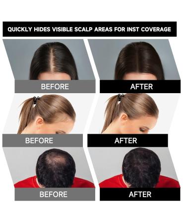 Shop Mifeloy Hairline Powder with Mirror & Sponge - Dark Gray Invisible Concealer for Hair | Waterproof Instant Makeup for Men & Women - Buy Online on GoSupps.com