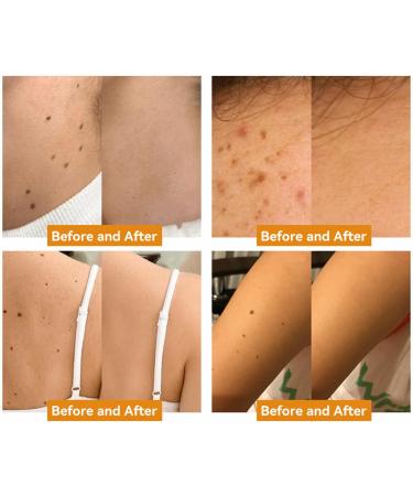 ZVLZVL Bee Venom Treatment Cream - Moisturizer & Skin Repair for Men & Women (30ml) | Buy Internationally - Buy Online on GoSupps.com