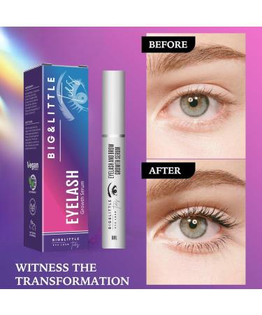 BIG&LITTLE TIES Eyelash Growth Serum - Enhance Broader Fuller Lashes & Brows (0.20 fl oz) - Best International Shipping - Buy Online on GoSupps.com