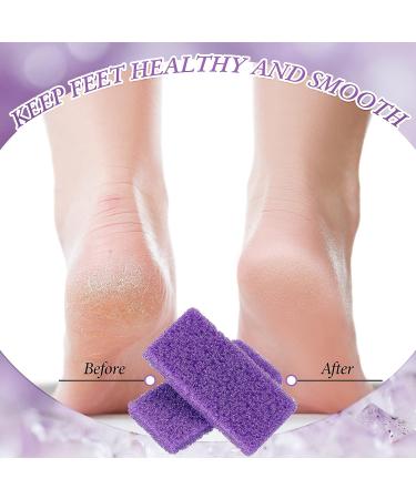 200 Pcs Disposable Pumice Stone for Feet - Pedicure Scrubber Exfoliator Sponge for Callus Remover - Buy Online on GoSupps.com