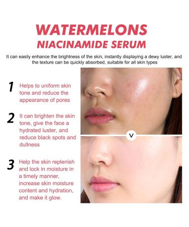 Watermelon Moisturizer Facial Serum - Hydrating Glow Priming Liquid Highlighter | International Shipping - Buy Online on GoSupps.com