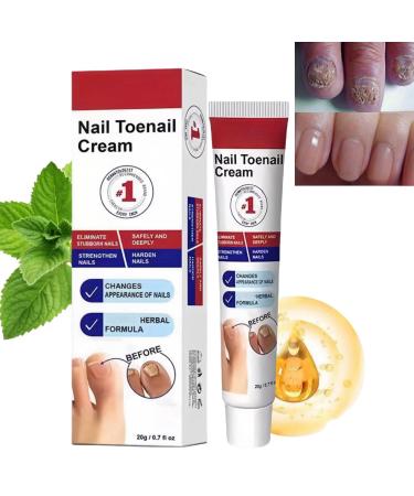 Fungal Nail Treatment Cream Antifungal Nail Polish Cream Nail Fungus Treatment for Toenail Strong Anti-Fungal Toenail Cream Nail Improve Cream Nail Repair Cream for Thick Cracked Discolored Nails