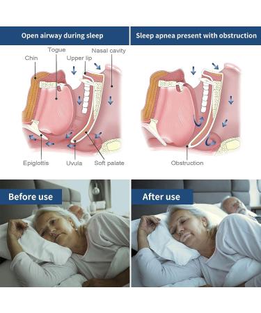 Soft Silicone Tape with Perforation for Improved Nasal Breathing and Snoring Relief (30PCS) - Buy Online on GoSupps.com