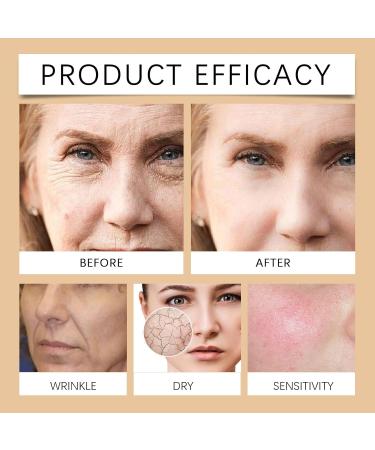 Retinol Anti-Wrinkle Cream for Women - Anti-Aging Face & Neck Moisturizer with Collagen & Hyaluronic Acid - Hydrating Treatment for Neck D collet & Jawline - Firming & Smoothing 1.76oz - Buy Online on GoSupps.com