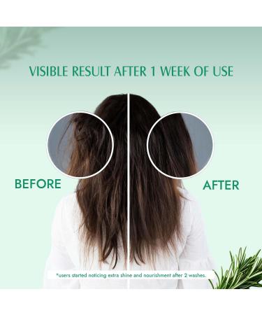 Rosemary Hair Growth Conditioner | Sulfate & Paraben Free | Enriched with Rosemary Green Tea & Caffeine | For All Hair Types | 6.7 FL Oz - Men & Women - Buy Online on GoSupps.com